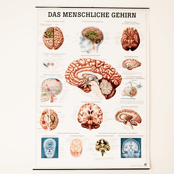 Lehrtafel "Das menschliche Gehirn" M